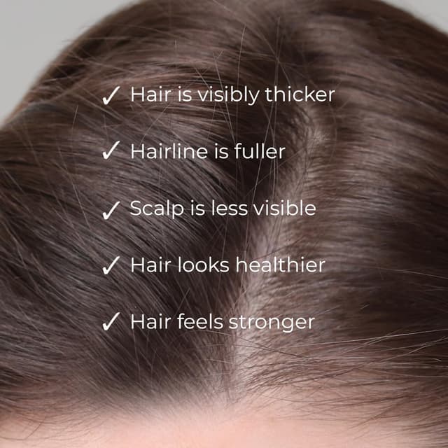 Detalle de Nanogen Hair Growth Factor Treatment – sérum pour la pousse des cheveux à l’extrait de pea sprout, écorce et peptides (30 ml)