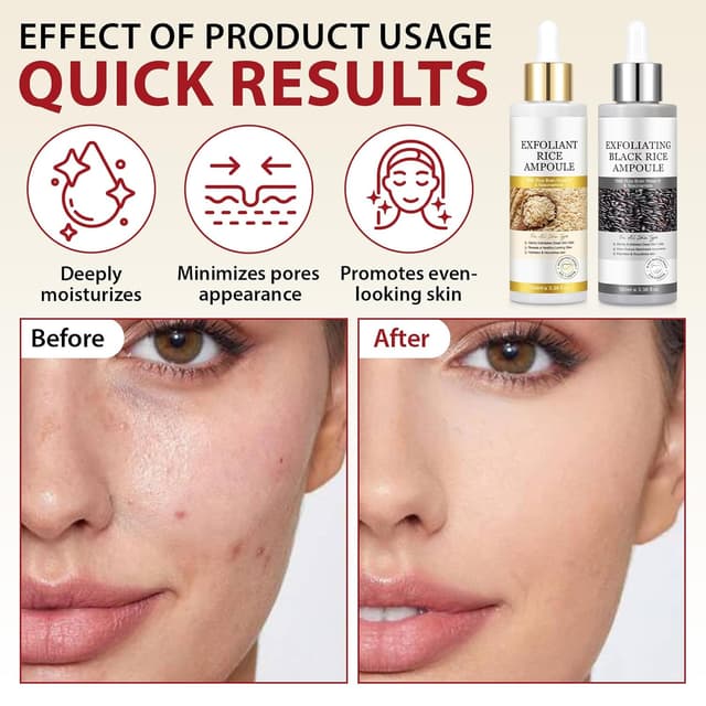 Thumbnail 4 de Furnrubden Peel Shot Glow Rice Ampoule Duo