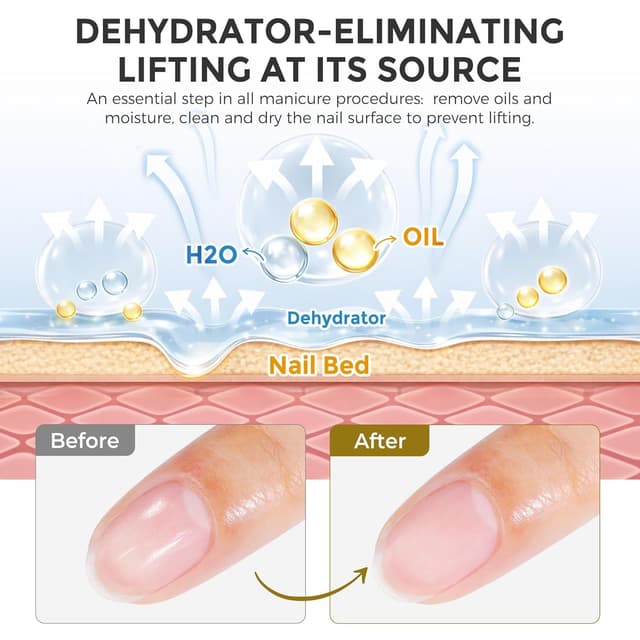 Detalle de UNA GELLA Nail Primer & Nail Prep Dehydrator Set (10 ml) für Press-on, Acryl und Gel-Lack – Haftvermittler mit Anti-Lifting-Effekt