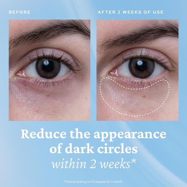 Thumbnail 3 de belif Aqua Bomb Cooling Eye Gel 15ml 📷