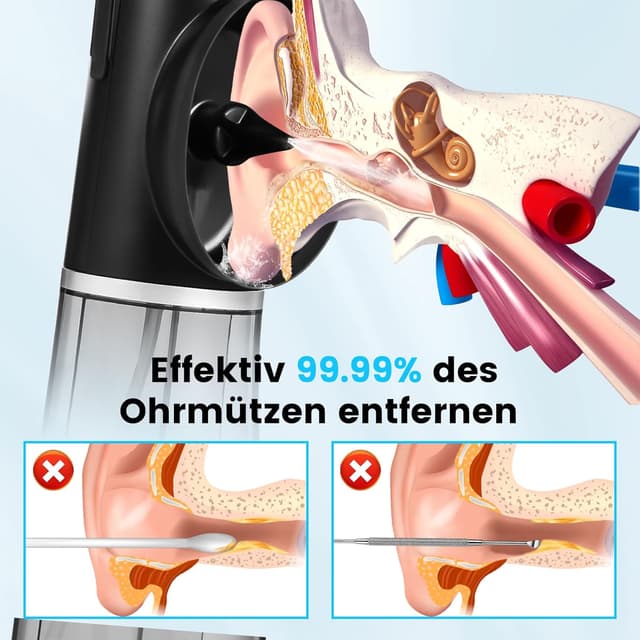 Detalle 2 de Scian Elektrischer Ohrenreiniger mit integriertem Doppeltank, 4 Druckstufen und 6 Ohr-Tipps (IPX7) – Ohrenschmalz Entferner