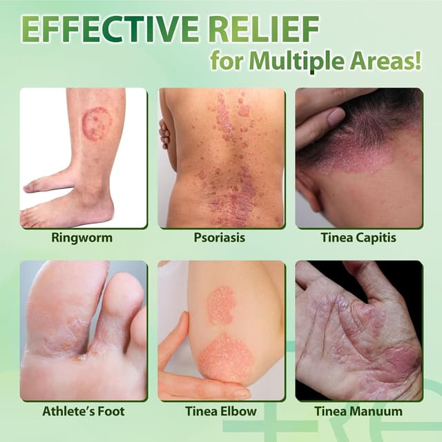 Detalle de Natürlich Antimykotika Hautpilz Creme 30 g