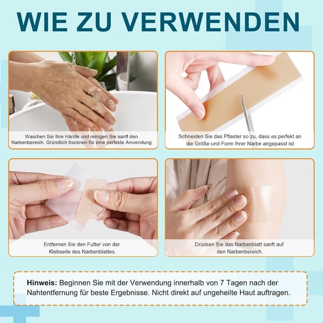 Detalle de Silikon-Narbenpflaster (4 cm x 1,9 m) – Silicone Scar Tape, hautverträglich, atmungsaktiv & wasserfest