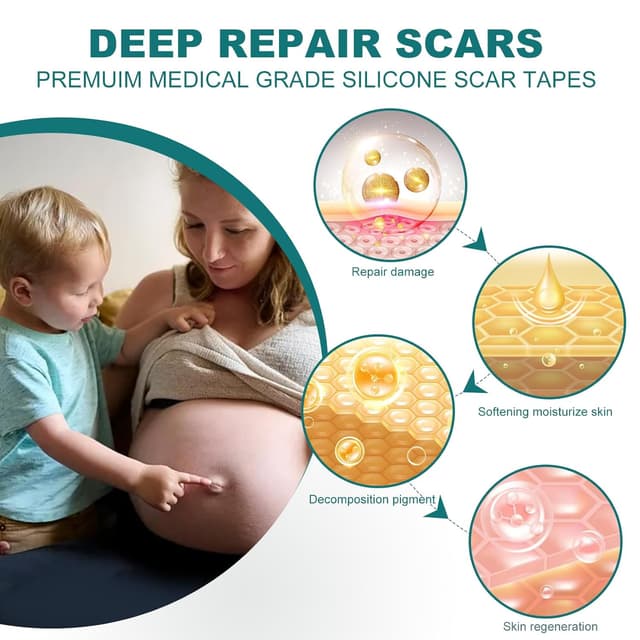 Detalle de Silicone Scar Sheets 1.6" x 158" Roll