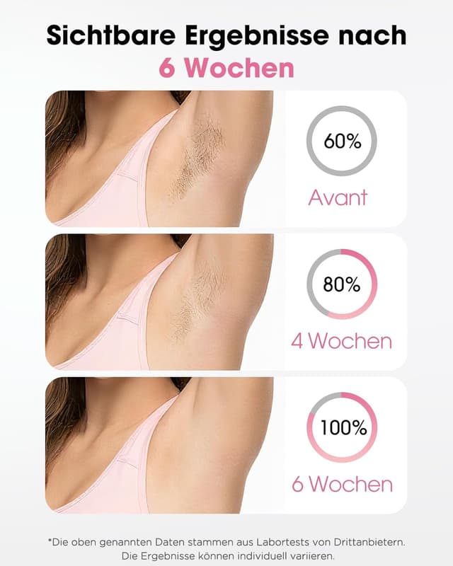 Thumbnail 2 de TIIMAGIC IPL Geräte Haarentfernung 1200nm Filter