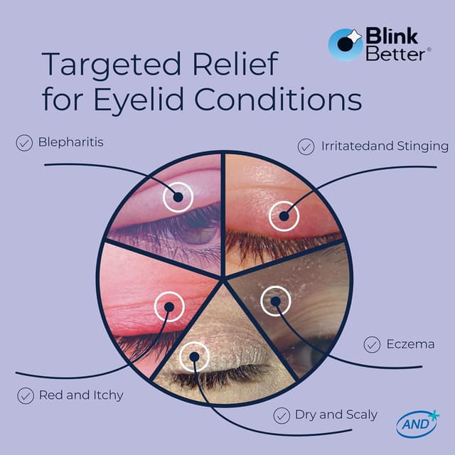 Detalle 1 de BlinkBetter BetterLids Eyelid Ointment 0.34 oz