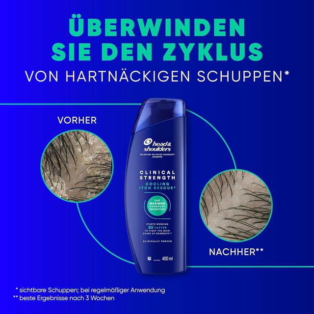 Detalle de Head & Shoulders Cooling Itch Rescue Anti-Schuppen Shampoo 400 ml