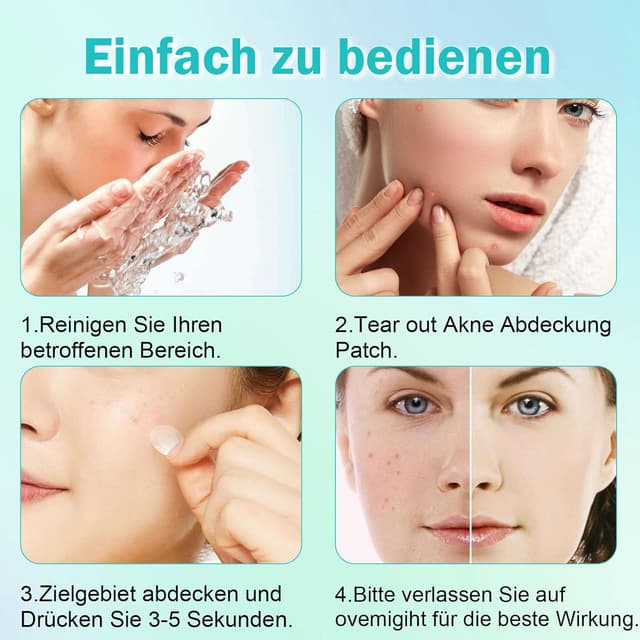 Thumbnail 6 de Pimple Patches Pickel Patch 264 Stück