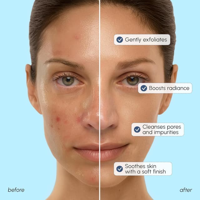 Detalle de MAREE Face Exfoliator Microdermabrasion