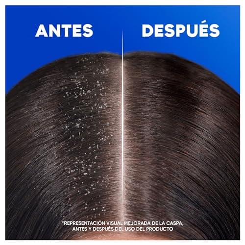 Thumbnail 3 de h&s Classic Champú Anticaspa 2x1000ml