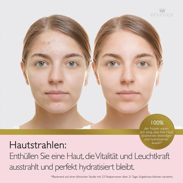 Detalle 2 de Revitale Advanced Salicylic Acid Cream für Gesicht & Körper (80 g) – gegen raue, holprige und zu Unreinheiten neigende Haut