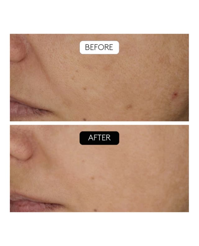 Thumbnail 4 de Cocunat Sérum Antiarrugas Clinical Beauty Filler 30 ml