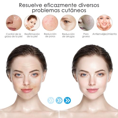 Thumbnail 4 de Dr Pen Ultima M8, 20 aiguilles 36 broches ⚙