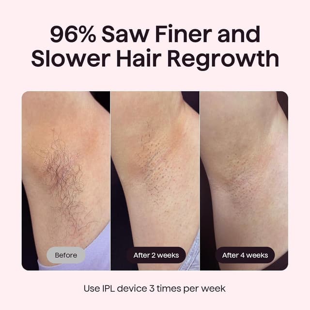 Detalle 1 de Wavytalk Bare It IPL 24J Full Body