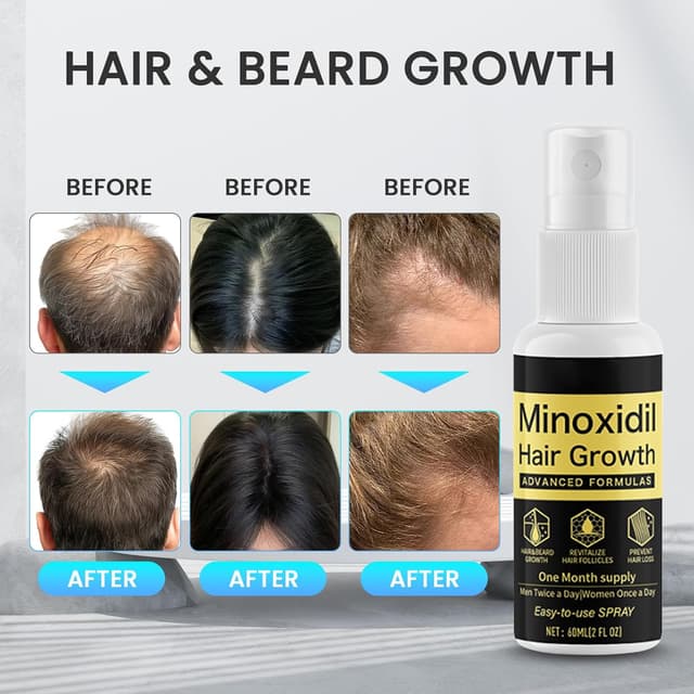 Thumbnail 4 de Xinweini Minoxidil 5% 3-pack