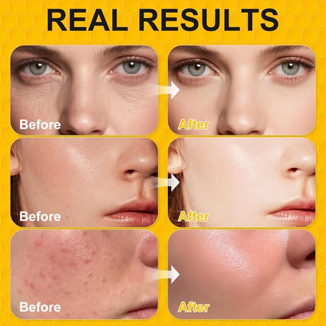 Detalle 1 de BIETCR Organic Grass-Fed Beef Tallow Balm (Unscented, 4.2 oz) for Face, Body, Lip Care & Eczema