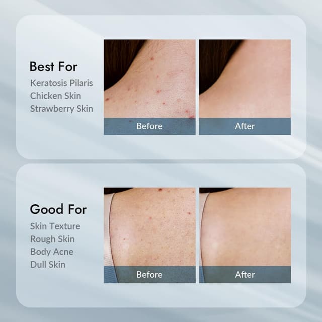 Thumbnail 6 de V11FACTORY AHA 12% Glycolic Acid Body Lotion (Unscented) with Hyaluronic Acid & Collagen