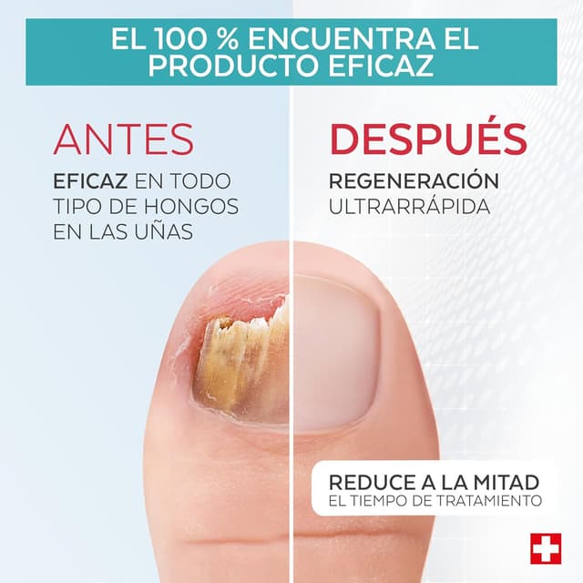 Detalle 1 de PODERM Micosis Uñas Intensificador