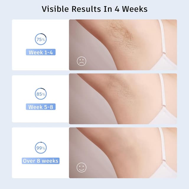 Detalle 2 de Laser hair removal IPL 999 flashes device