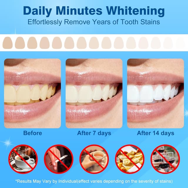 Thumbnail 3 de Teeth Whitening Strips 14 Treatments
