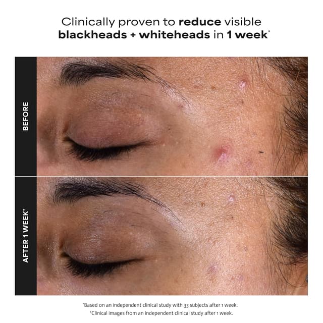 Detalle 2 de Paula's Choice Skin Perfecting BHA 2% Salicylic Exfoliant