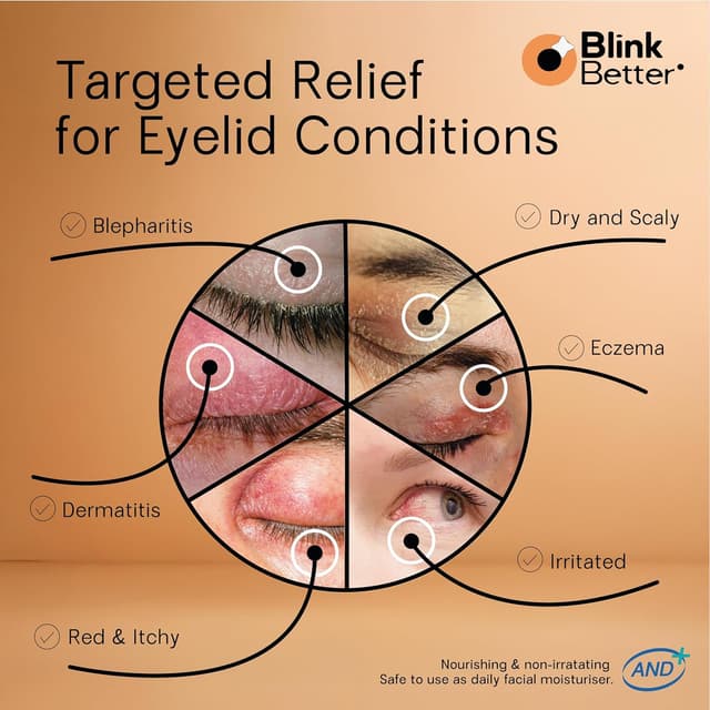 Detalle 2 de BlinkBetter BetterLids Restore Eyelid Cream (3% Oat & Ceramides) — Barrier Support for Dry, Itchy, Red Eyelids, 1 fl oz