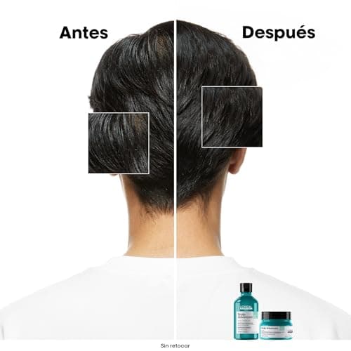 Detalle de L’Oréal Professionnel Scalp Advanced champú antigrasa 500 ml