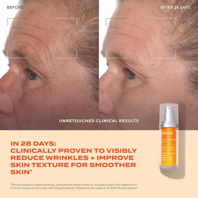 Detalle de Murad Rapid Dark Spot Correcting Serum with Glycolic Acid (30ml) – Environmental Shield