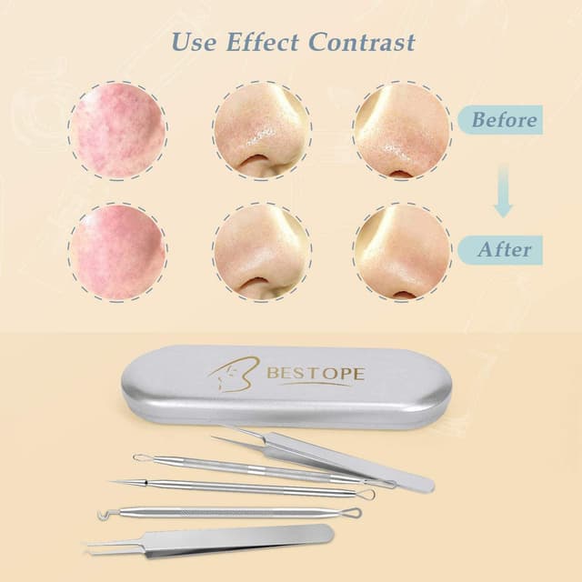 Detalle 2 de BESTOPE PRO Mitesserentferner 6–teiliges Set