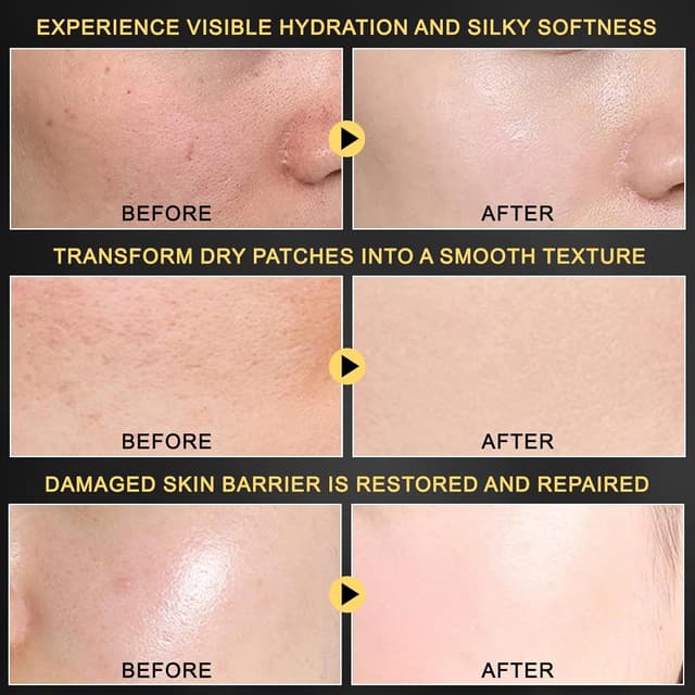 Thumbnail 2 de Mascarilla Facial de Hidrogel Advanced Snail Mucin Glass Glow