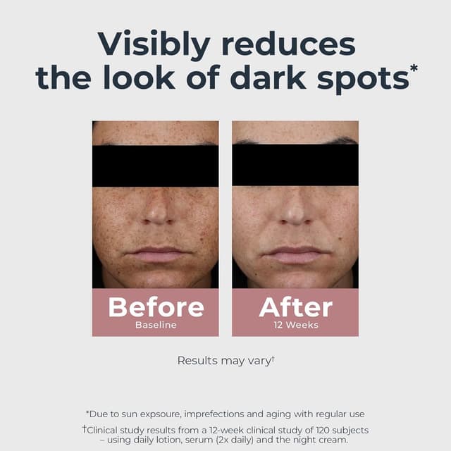 Detalle de Eucerin Radiant Tone Night Cream with Thiamidol (Dark Spot Corrector) 1.7 oz