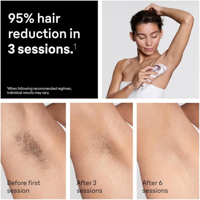 Detalle de Braun Silk Expert Pro 5 IPL5100 hair removal