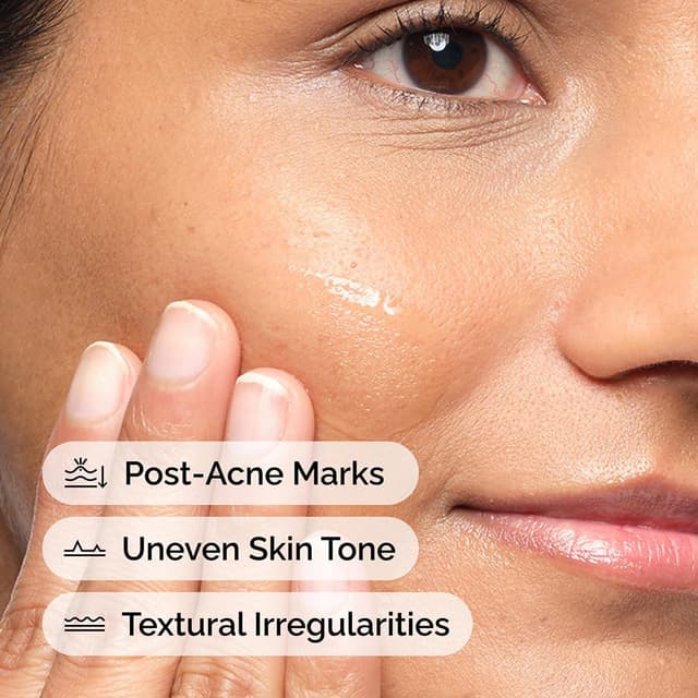 Detalle 2 de The Ordinary Aloe 2% NAG 2% 30ml