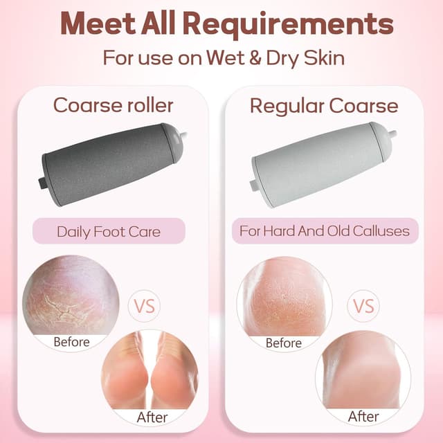 Detalle 2 de Hornhautentferner Elektrisch – Fußpflege Set für harte Haut 1 Stück