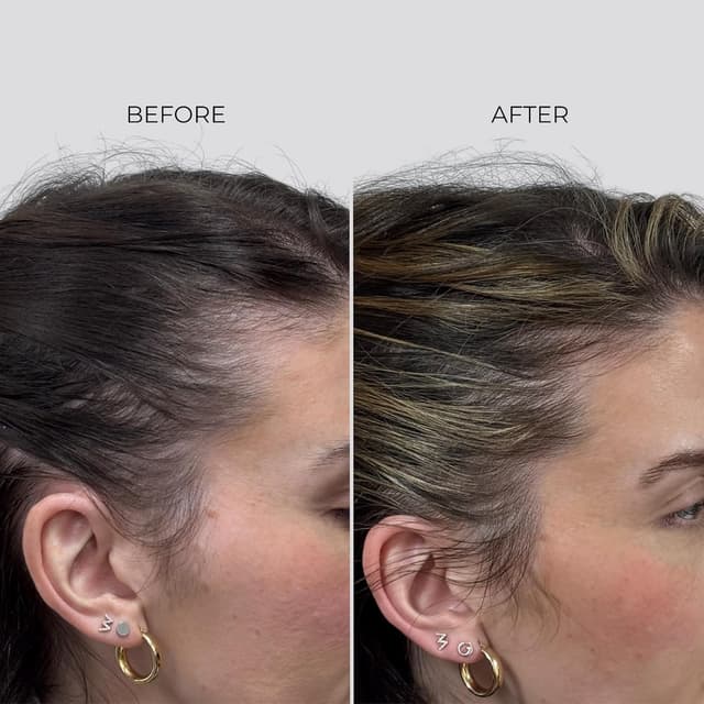 Detalle de Nanogen Hair Growth Factor Treatment – sérum pour la pousse des cheveux à l’extrait de pea sprout, écorce et peptides (30 ml)