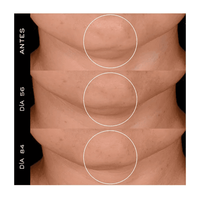 Thumbnail 1 de Lancôme Rénérgie H.P.N 300‑Peptide crema 50 ml