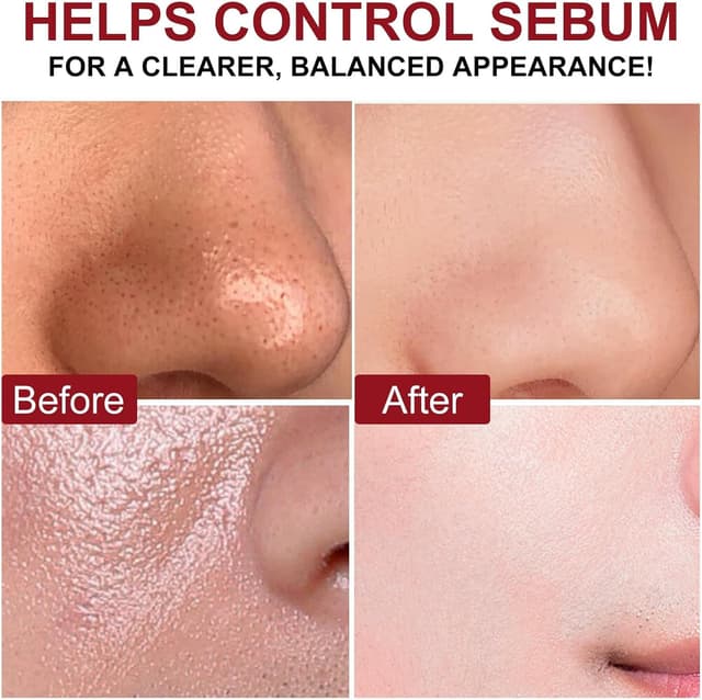 Detalle 1 de Peel Shot Glow Rice Ampoule Duo, siero 2 pack