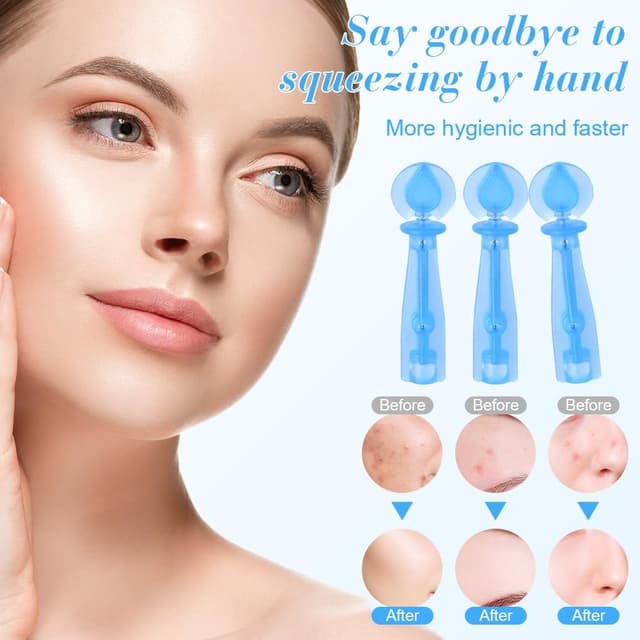 Detalle de LOPHE Extracteur de points noirs avec 100 aiguilles jetables et 2 outils 2-en-1