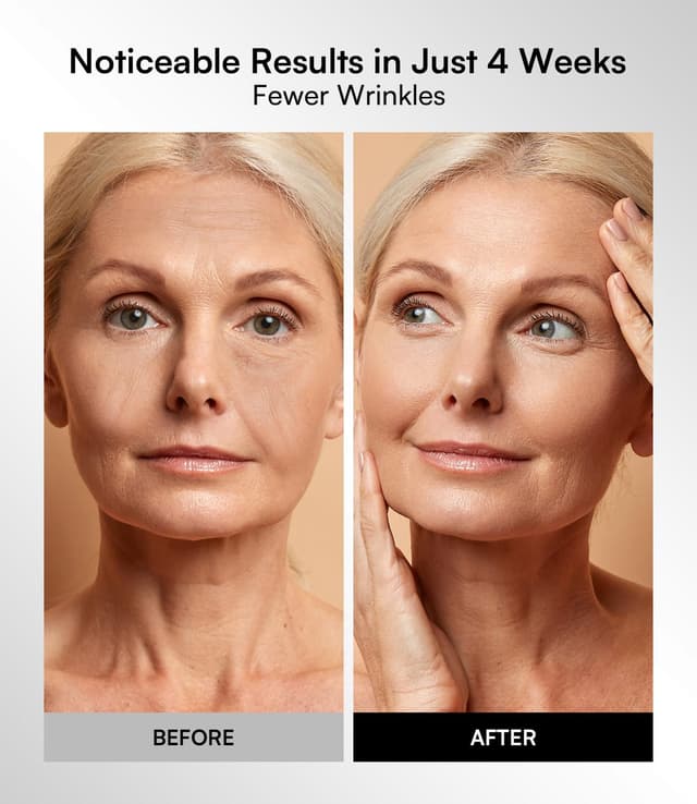 Detalle 2 de INIA Red Light Therapy Mask 2600mAh 🧖♀