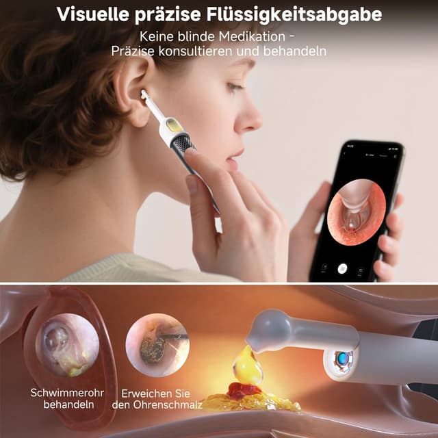 Thumbnail 3 de BEBIRD R1 Ultra Ohrenschmalz-Entferner Otoskop für Zuhause