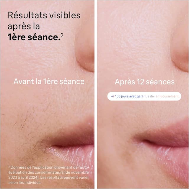 Detalle de Braun i·expert PL7387 IPL 10 minutes