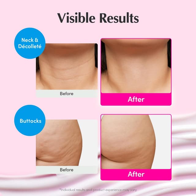 Detalle de EQQUALBERRY NAD+ Peptide Cream 5%