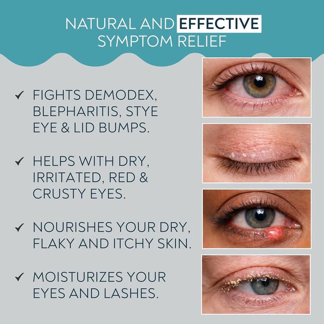 Detalle de Demodex Eyelid Cleanser Foam with Extra Strength Tea Tree Oil (3.38 fl oz / 100ml) — Daily Wash for Eyelids & Eye Irritations