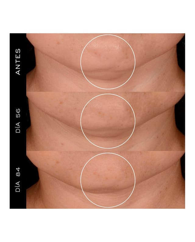 Thumbnail 5 de Lancôme Rénergie H.P.N. crema anti-edad 50 ml