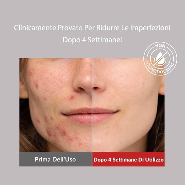 Thumbnail 4 de MIZON Good Bye Blemish Detergente pH basso