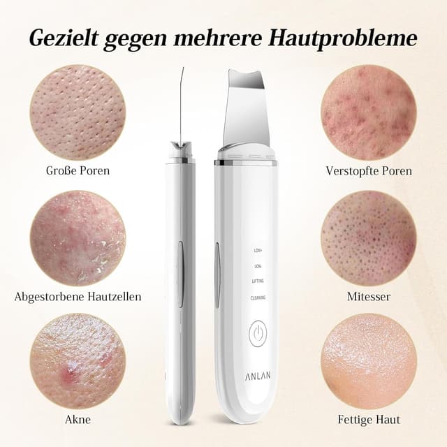 Thumbnail 5 de ANLAN Skin Scrubber Pulizia Viso 4 modalità 🧖♀