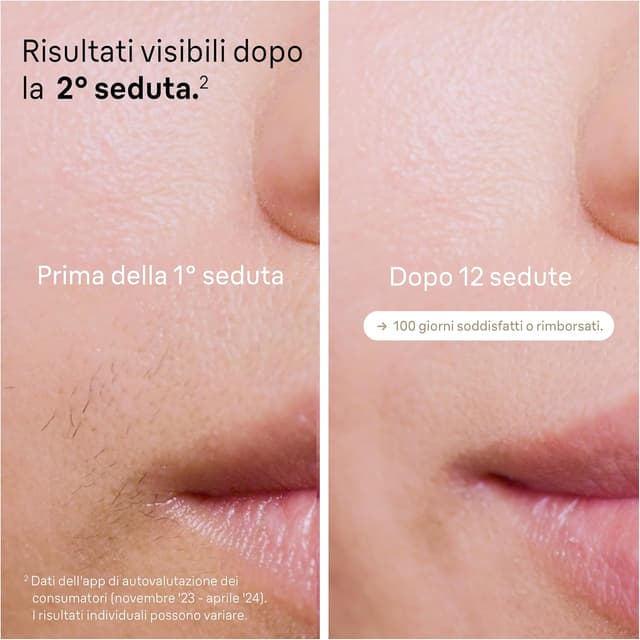 Thumbnail 2 de Braun Silk·expert Pro 5 epilatore a luce pulsata con rasoio e 4 testine