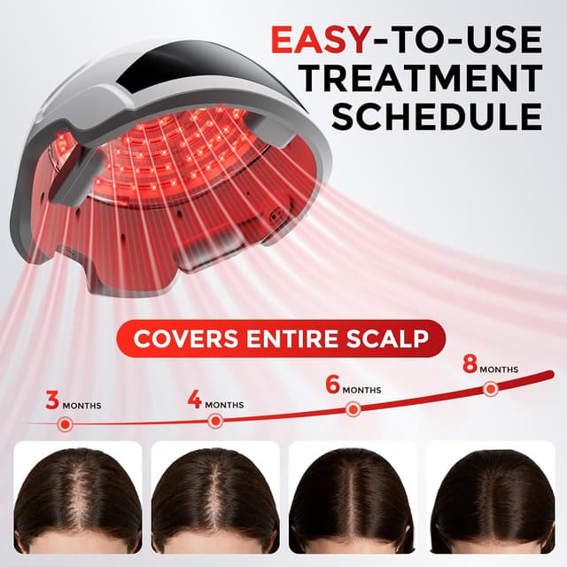 Detalle de OVEKPA Red Light Therapy Laser Cap for Hair Growth (FDA-cleared) — at-home LLLT for men & women