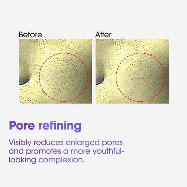 Detalle de SOME BY MI Retinol Intense Advanced Triple Action Eye Cream – crème contour des yeux au rétinol – 30 ml