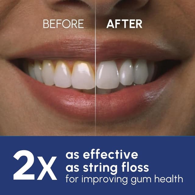 Thumbnail 2 de Waterpik WP-662UK Ultra Professional Water Flosser 650 ml